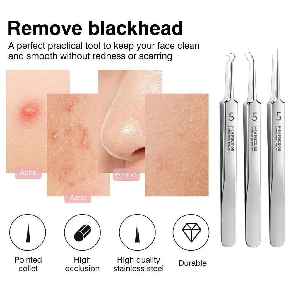 German Ultra-fine No.5 Cell Pimples Blackhead Clip 0.1mm Blackhead Remover Tweezers Black Dots Pore Cleaner Acne Needle Tool