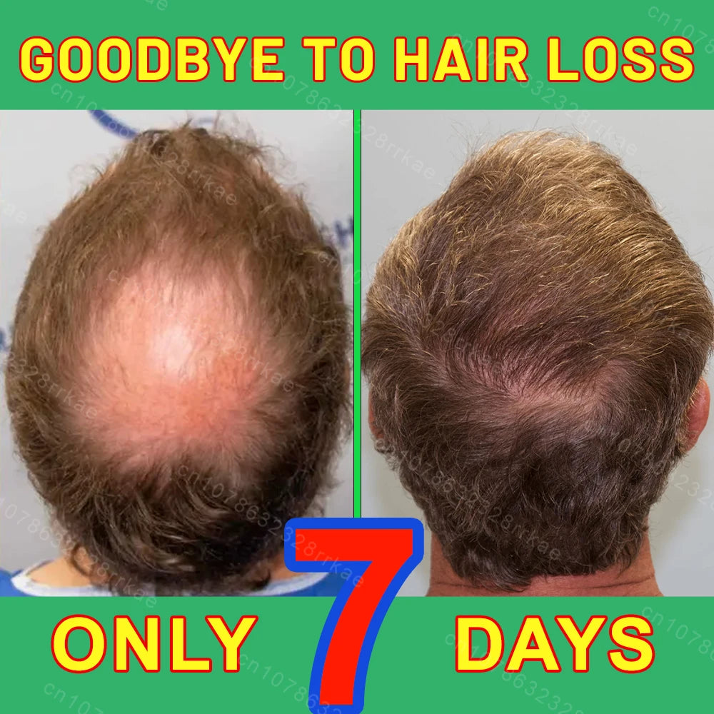 Hair growth products  Hair care Repairs Nourishes Damaged Hair Scalp Fast Hair Growth