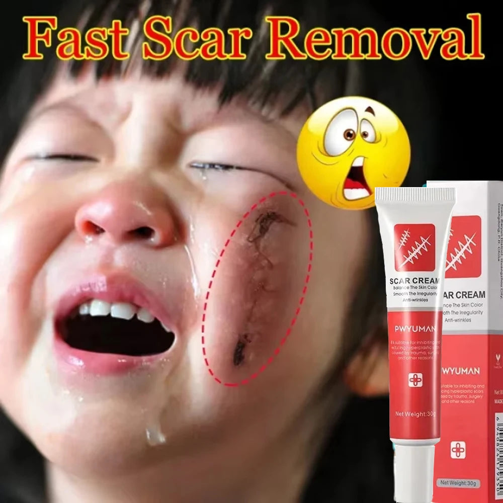 Scar Removal Cream Effective Stretch Marks Burn Surgical Scars Treatment Ointment Acne Spot Moisturizing Repair Body Skin Care