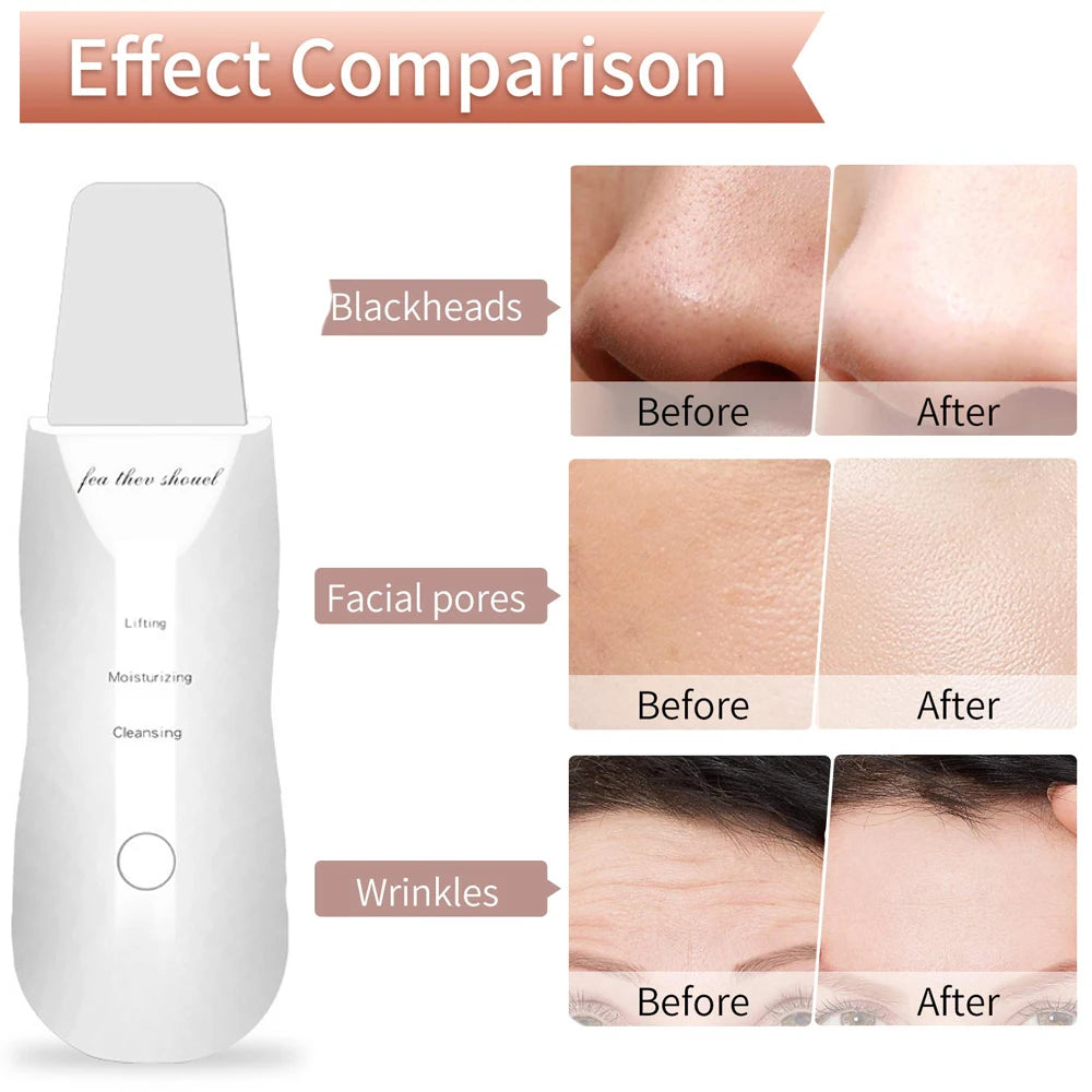 Electric Skin Scrubber Peeling Blackhead Remover Deep Face Cleaning Lifting Ion Acne Pore Cleaner Facial Spatula Shovel Cleanser