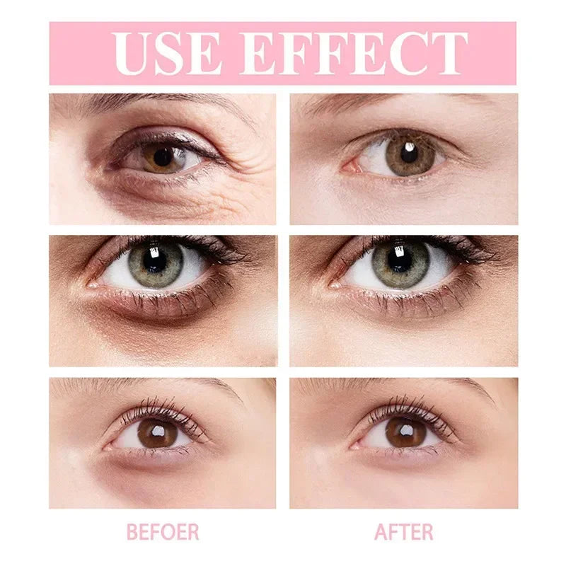 Retinol Eye Cream Instant Removing Eyes Wrinkle Eyes Dark Circles Bags Remove Moisturizing Stick Skin Care Korea Cosmetics New