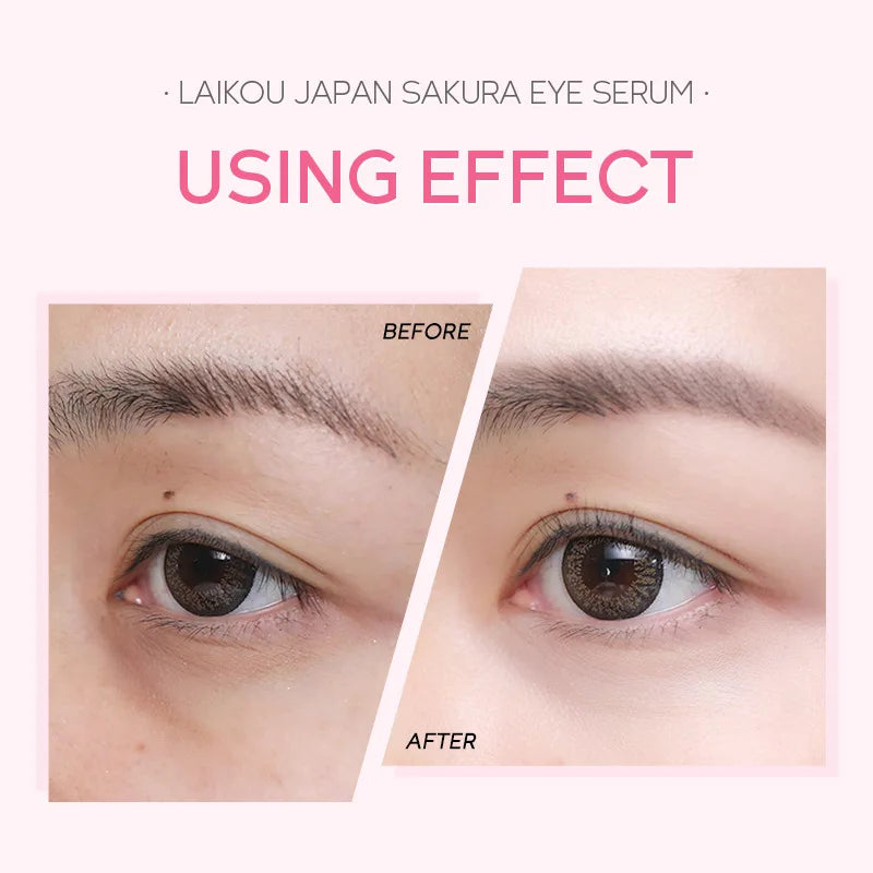 LAIKOU Sakura Eye Serum Eye Roller Massage Vitamin C Hyaluronic Acid Skin Care Eye Bags Cream Moisturizing Dark Circles 15ml