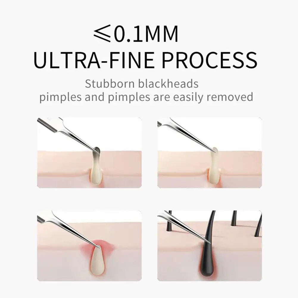 German Ultra-fine No.5 Cell Pimples Blackhead Clip 0.1mm Blackhead Remover Tweezers Black Dots Pore Cleaner Acne Needle Tool