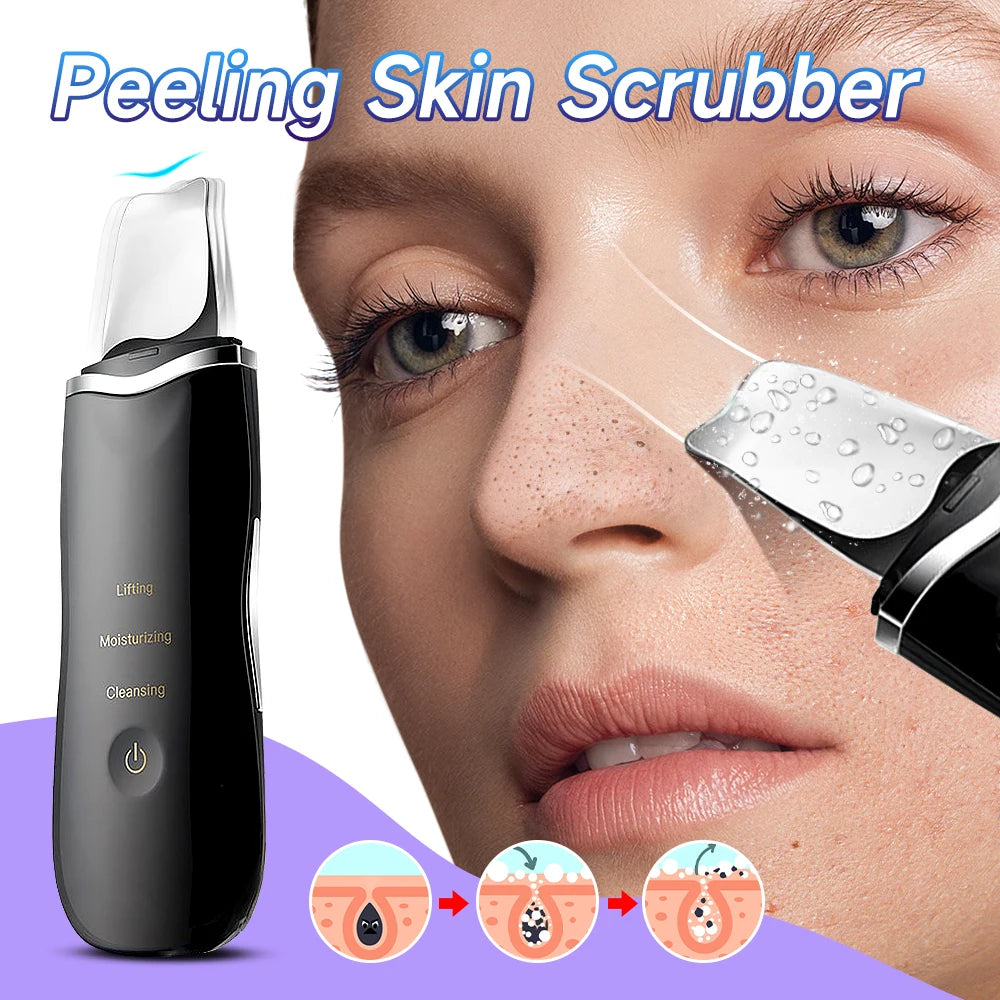 Electric Skin Scrubber Peeling Blackhead Remover Deep Face Cleaning Lifting Ion Acne Pore Cleaner Facial Spatula Shovel Cleanser